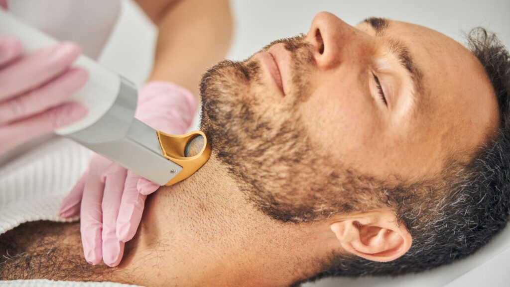 Laser Hair Removal Men