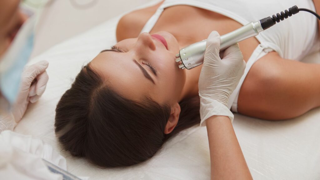 Laser Treatments for Acne