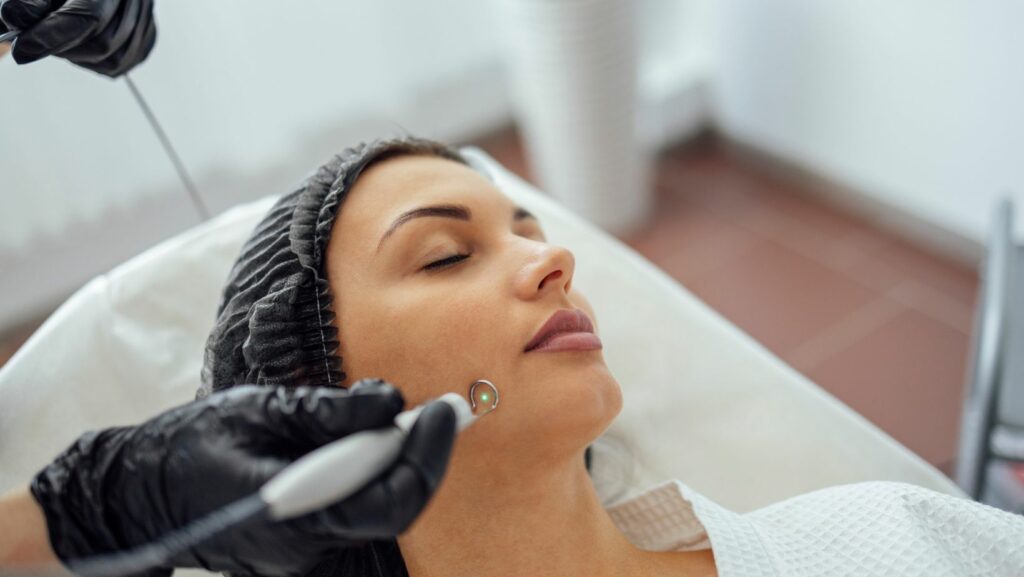 Laser Treatment for Pigmentation