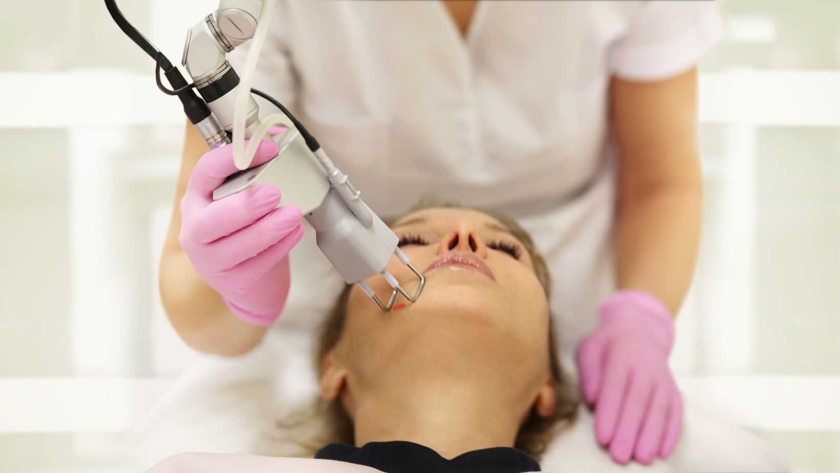 Laser Treatments for Dark Spots